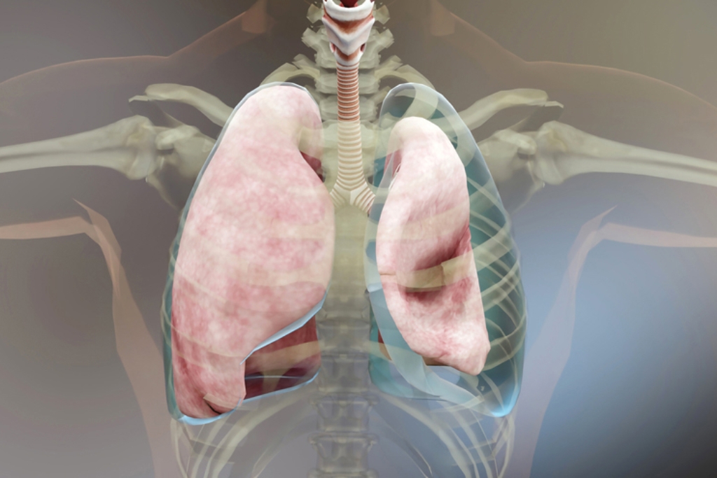 Pneumothorax treatment by pulmonologist in Vadodara